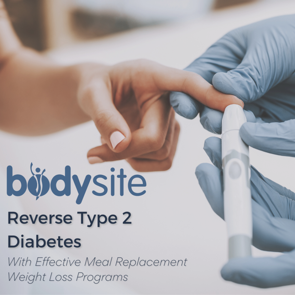 Reverse Type 2 Diabetes with Effective Meal Replacement Weight Loss